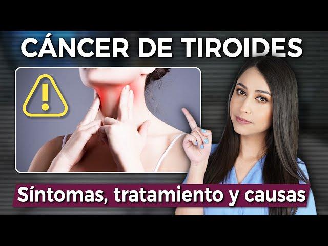 THYROID CANCER: Symptoms and treatment‍️ @DraPauZuniga