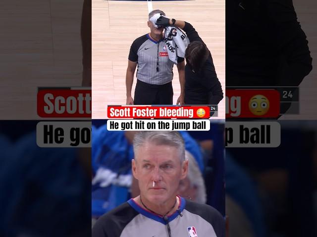 Scott Foster's nose was bleeding 