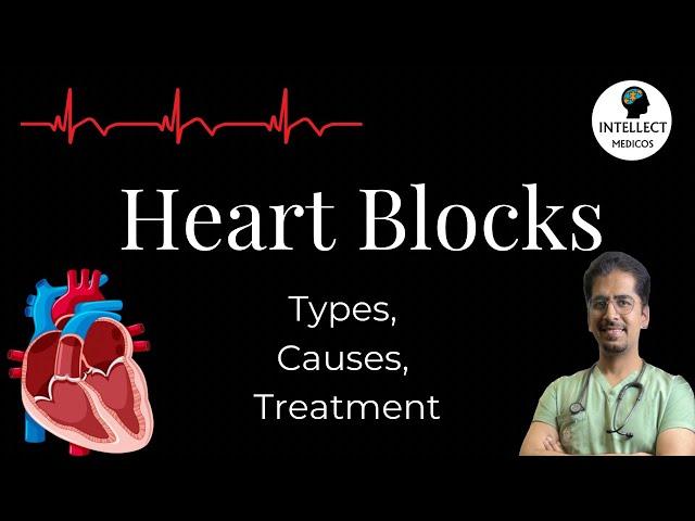 Heart Blocks (Types, Causes, ECG findings, Treatment)