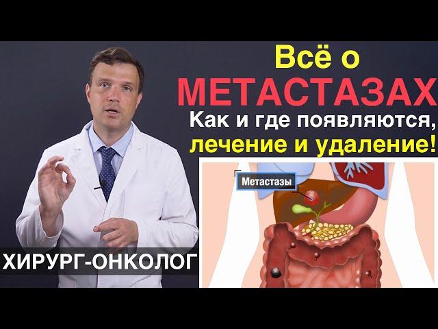 Что такое метастазы рака. Причины появления метастазов - лечение и удаление. Лечение рака и метастаз