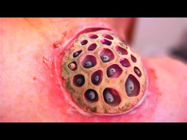 10 Most Dangerous Bugs Around The World