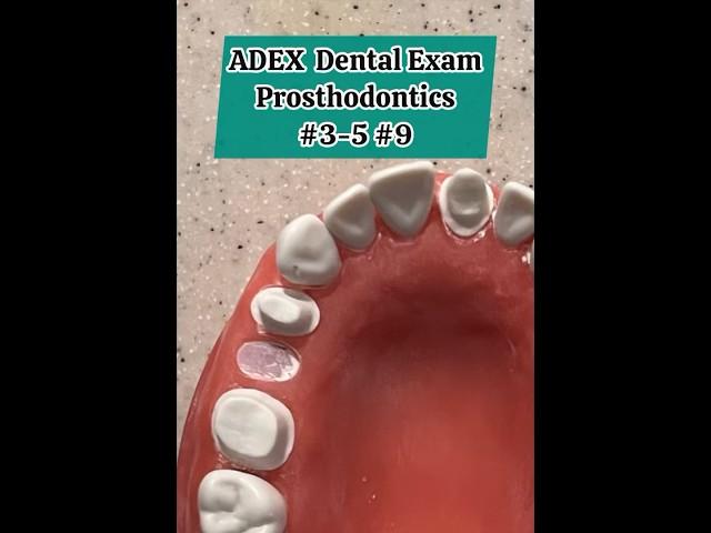 ADEX Dental Exam - Prosthodontics Crown Preps #adex #dental #exam #dentist