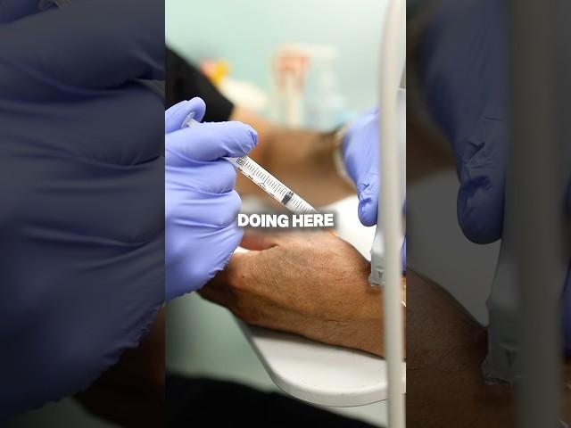 How to relieve pain from arthritis? #painrelief #arthritis #painmanagement