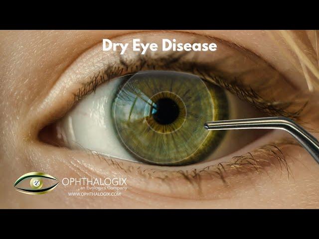 Revolutionizing Dry Eye Treatment: Discover Ophthalogix's Eclipse & Aurora Solutions