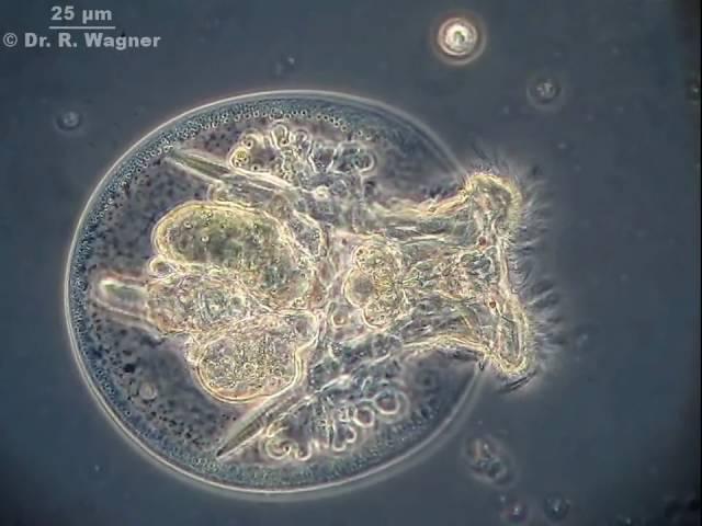 Testudinella patina, a rotifer