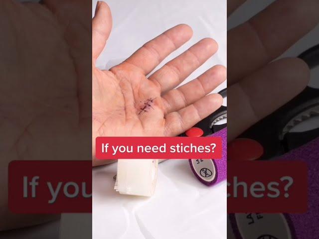 Doctor reacts: Doing your own stitches, gone wrong