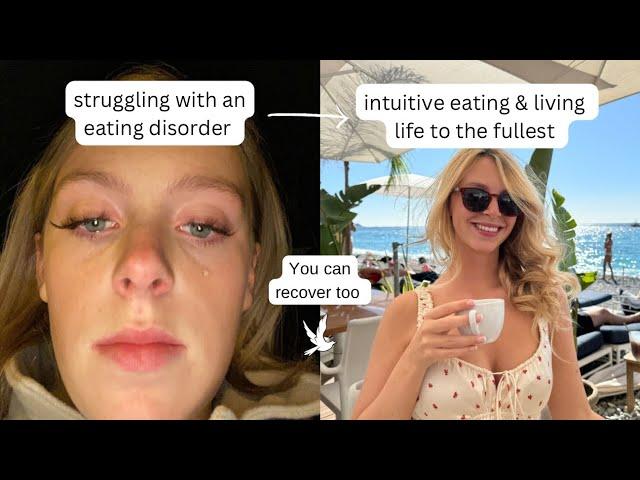 Your eating disorder recovery won't look like anyone else's | healing takes time