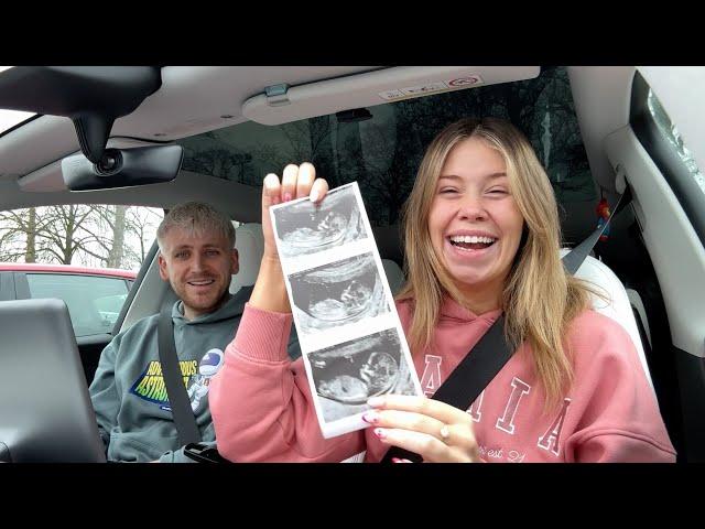 How I'm Coping & Seeing Our Baby For the First Time