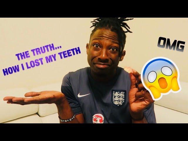 THE TRUTH (HOW I LOST MY TEETH)