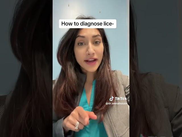 How to Diagnose Lice | Dr. Amna Husain #shorts #lice