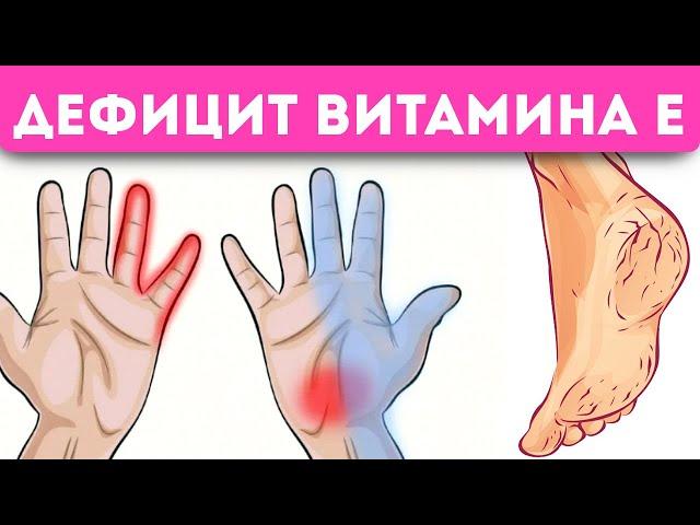 10 скрытых признаков, что у Вас дефицит витамина Е (покажем как быстро исправить)