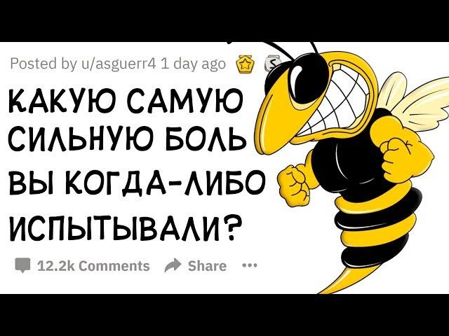 (Апвоут) Какую Самую Сильную Боль Вы Когда-либо Испытывали?