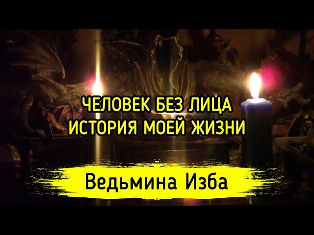 ЧЕЛОВЕК БЕЗ ЛИЦА. ИСТОРИЯ МОЕЙ ЖИЗНИ. ВЕДЬМИНА ИЗБА ▶️ ИНГА ХОСРОЕВА