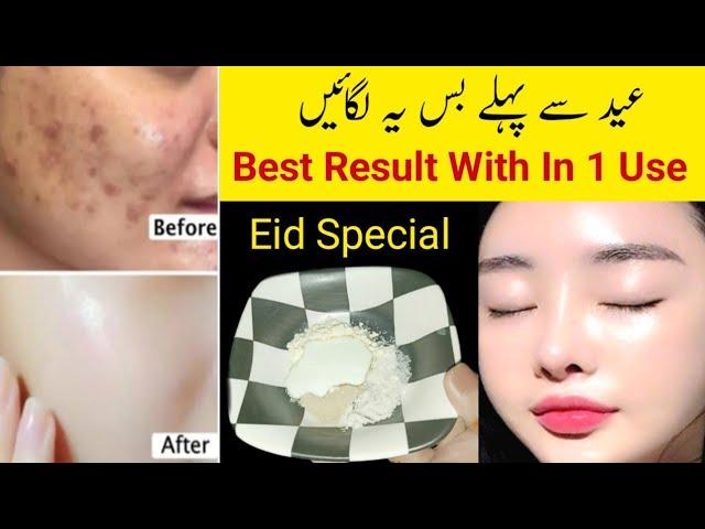 Multani Mitti Face Pack For Glowing Skin| 1 Day Skin Whitening Challenge | Skin Whitening Remedies