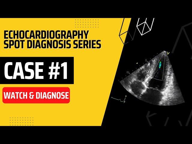 Case 1: Echocardiography Spot Diagnosis Case Series | Watch & Diagnose | Learn Echo Findings | TOACS