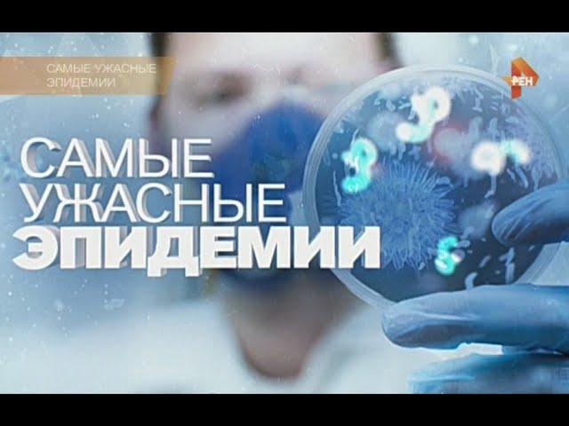 Самые ужасные эпидемии 01. 04. 2016. Документальный спецпроэкт.