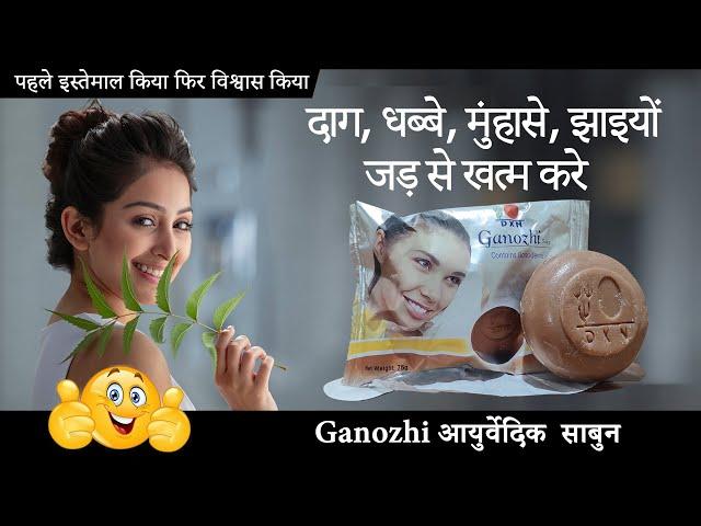 दाग, धब्बे,  झाइयों  जड़ से खत्म करे  |  DXN Ganozhi Soap Review