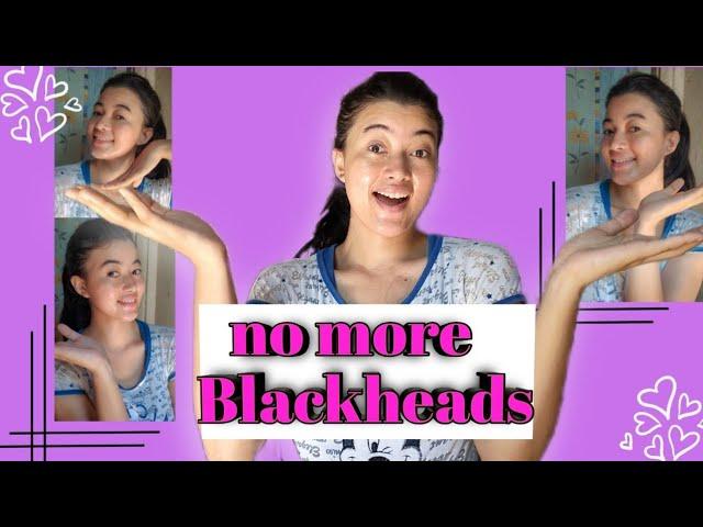 How to get rid of blackheads | RiTiSmiTa KaLiTa