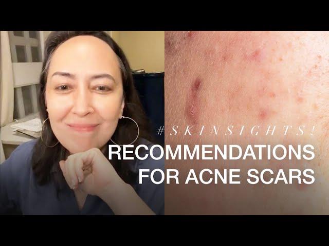 Recommendations For Acne Scars | VMV Hypoallergenics Snippets