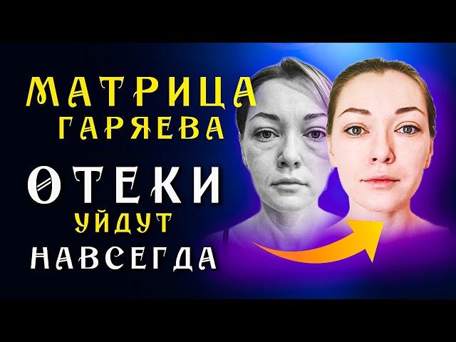 Матрица Гаряева для Очищения Лимфы ️ Восстановление Лимфатической Системы ️Исцеление Звуком