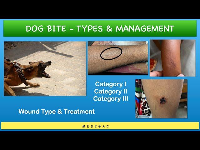 Dog bite - Category 1,2,3 || Wound types and Management/Treatment