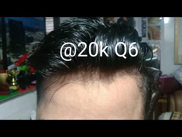 undetectable hair patch Q6 for wedding by DJ Johnny 9075156688 Mumbai