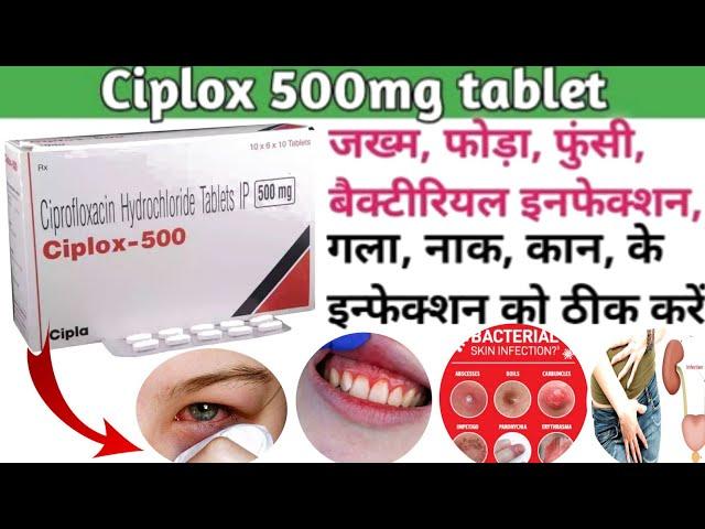 Ciplox 500 tablet | Ciplox 500 tablet uses in hindi | Ciprofloxacin tablet uses