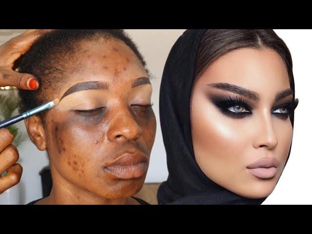 WOW  WHAT SHE WANTED VS WHAT SHE GOTMAKEUP TRANSFORMATION ️ CIRURGIA PLASTICA 