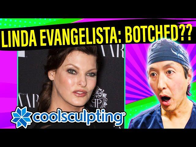 How to Avoid Linda Evangelista's CoolSculpting DISASTER! A Plastic Surgeon Explains