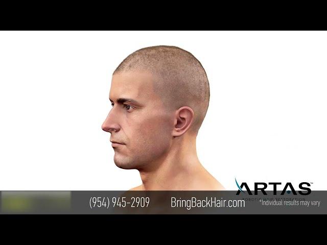 Hair By Dr. Max, Restoration Center (Fort Lauderdale, Florida)