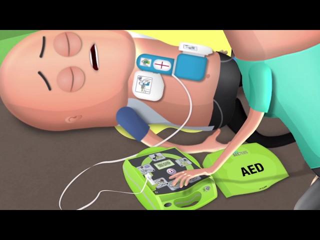 How to Respond to Sudden Cardiac Arrest