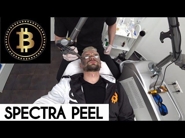 АППАРАТНАЯ КОСМЕТОЛОГИЯ – ЗАЧЕМ Я СДЕЛАЛ ПРОЦЕДУРУ SPECTRA PEEL. КРИПТОДЕПУТАТ-НАТУРАЛ НА БЬЮТИ.