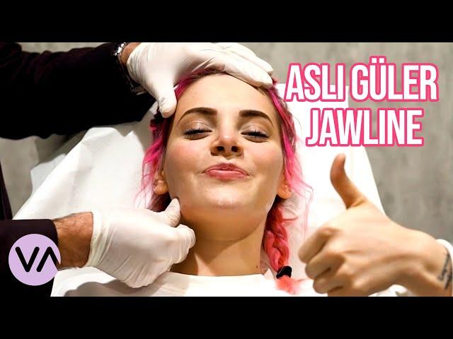 Aslı Güler Jawline Dolgusu | Vanity Estetik #Jawline #Dolgu @asliguler