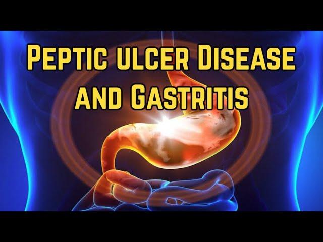 Peptic Ulcer Disease and Gastritis - CRASH! Medical Review Series