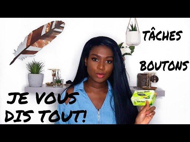 JE VOUS DIS TOUT ! Adieu les tâches, l'hyperpigmentation et les boutons !!!