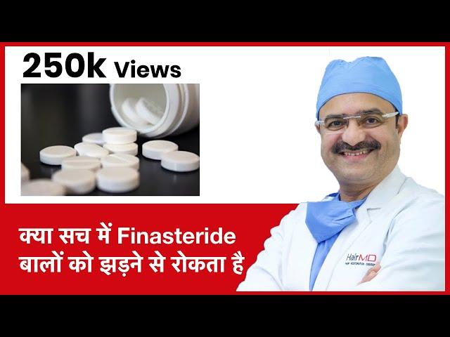 Finasteride Really Work For Hair Loss(क्या सच में Finasteride बालों को झड़ने से रोकता है)| (In HINDI)