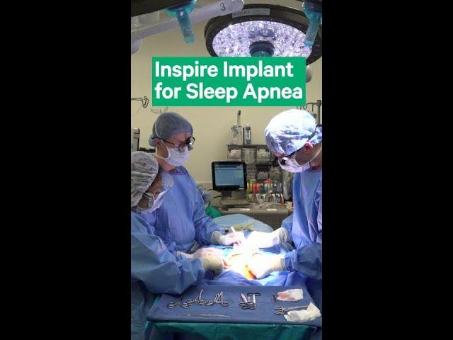 Inspire Implant for Sleep Apnea