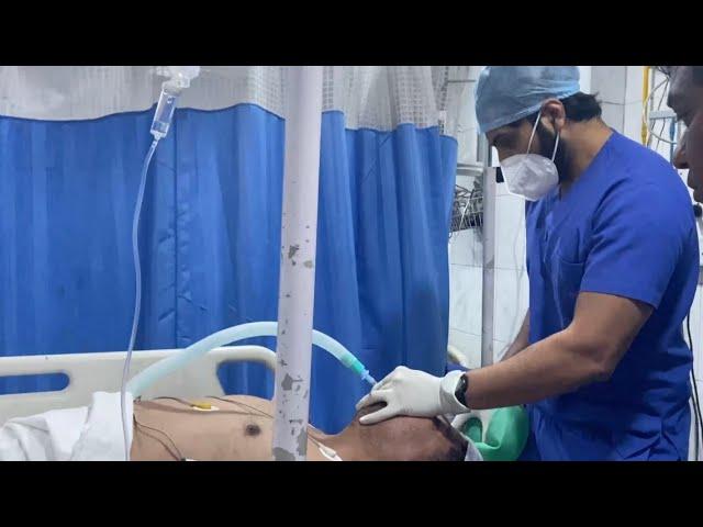 Real Life Emergency Intubation Procedure - Viewer Discretion Advised - Dr Rahul Singh MD