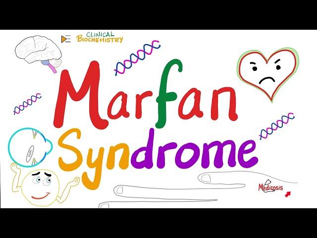 Marfan Syndrome - Causes, Symptoms, Diagnosis, and Treatment - Genetics