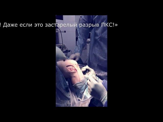 Застарелый разрыв передней крестообразной связки коленного сустава. Операция на связках колена.