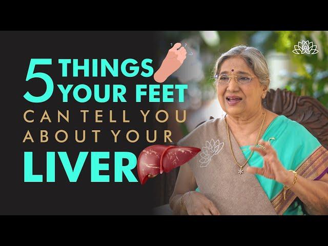 Your Feet Can Tell You About Your Liver's Health | Here are 5 Tips to Check Signs of Liver Problems