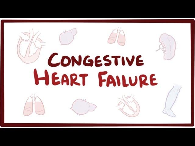 Congestive heart failure (CHF) - systolic, diastolic, left side, right side, & symptoms