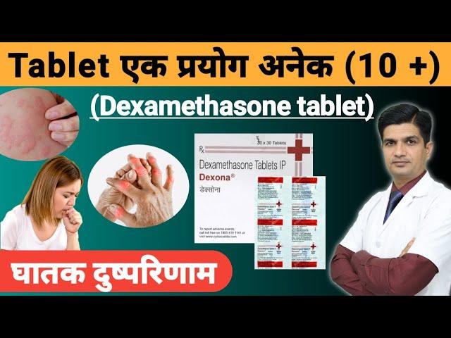 ज्यादातर प्रयोग वाली Tablet | Dexona tablet uses in hindi | Dexamethasone tablet