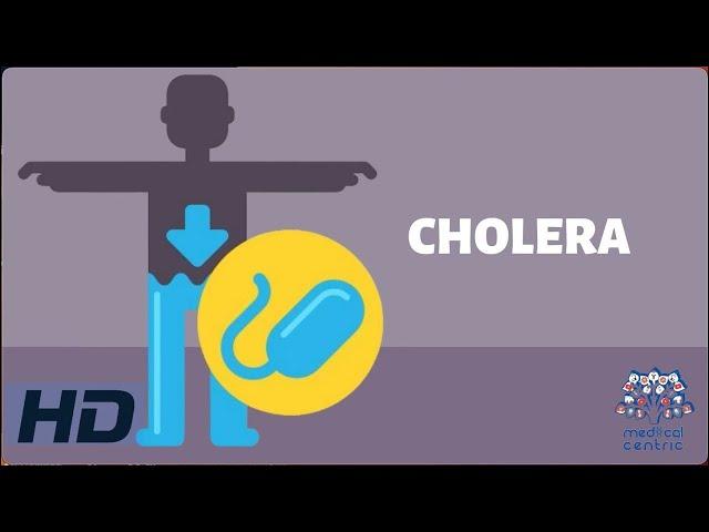 CHOLERA: Everything You Need To Know