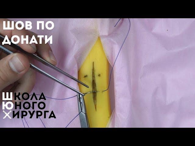 шов мак-миллана - донати или вертикальный п-образный шов (техника; как наложить)