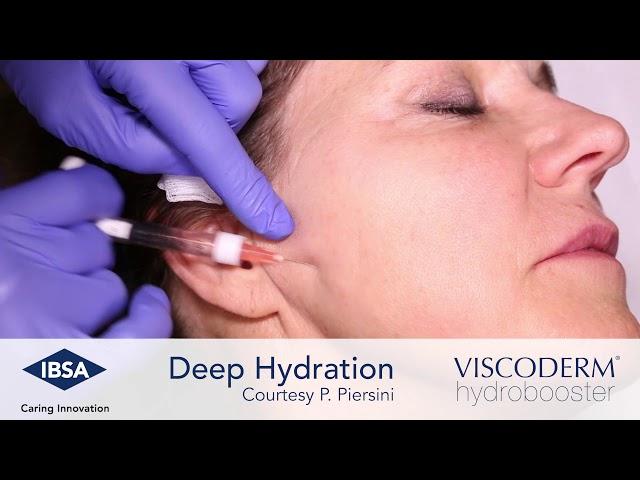 Viscoderm Hydrobooster Deep Hydration Malar Area