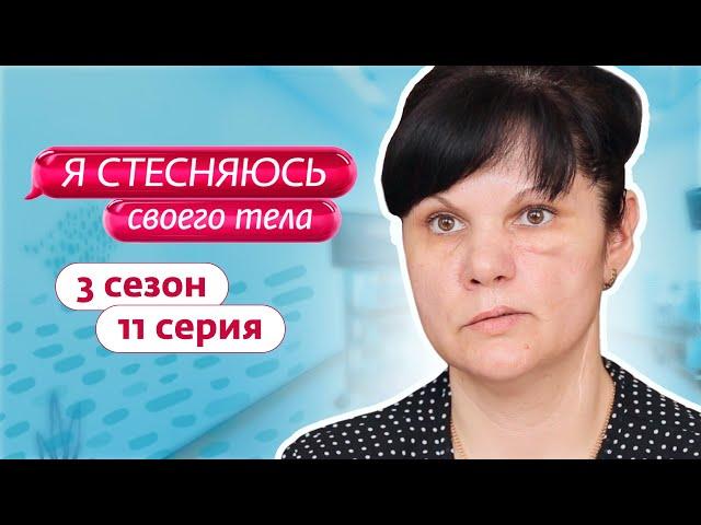 Я СТЕСНЯЮСЬ СВОЕГО ТЕЛА. РОССИЯ | 3 СЕЗОН, 11 ВЫПУСК