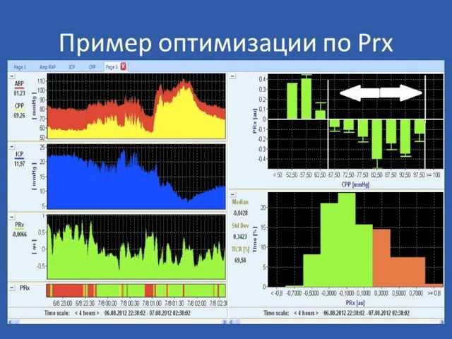 Оптимальная перфузия головного мозга.(РуНейро)