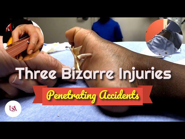 Three Bizarre Accidental Injuries