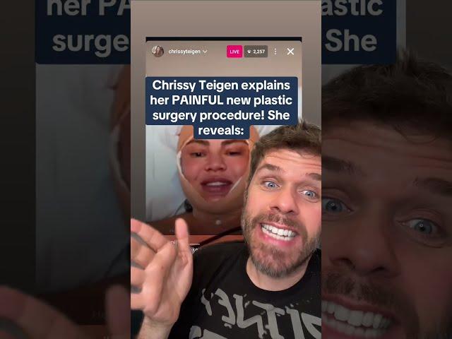 Chrissy Teigen Explains Her PAINFUL New Plastic Surgery Procedure! She Reveals: